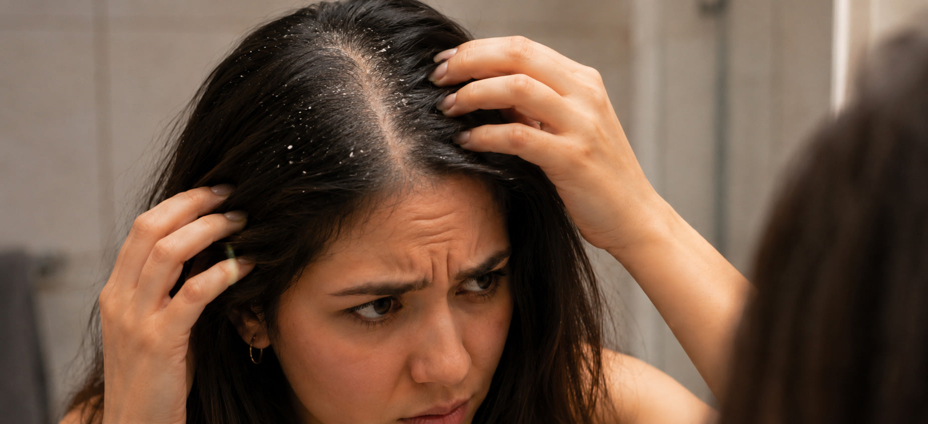 Woman examining flaky scalp in mirror