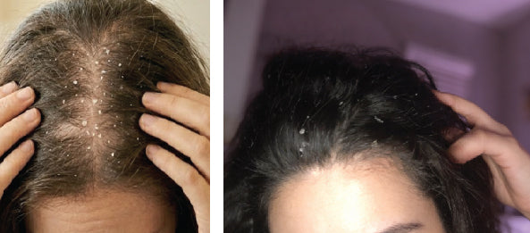 Damaged hair vs smooth hair